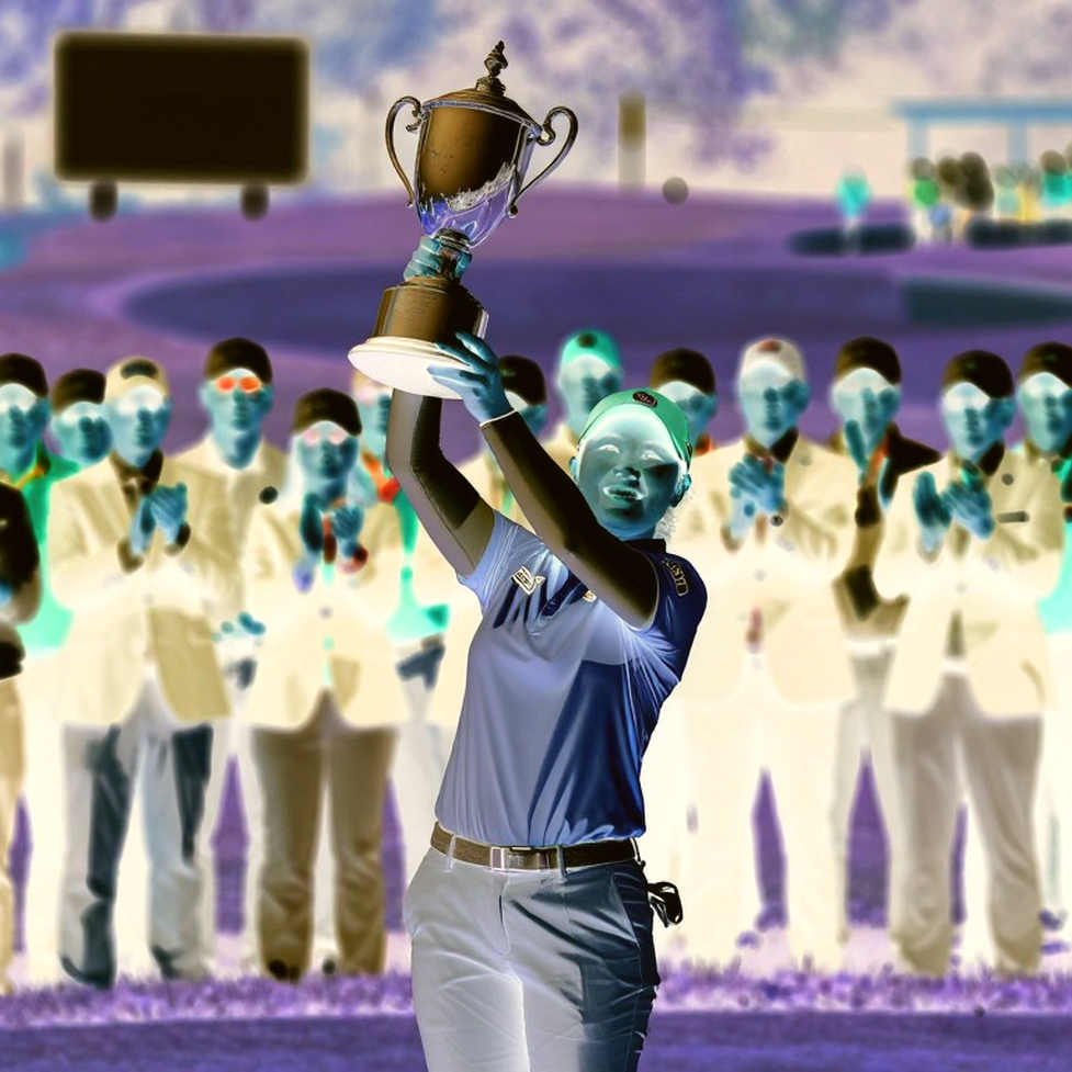 Will Zalatoris và ca phẫu thuật hợp nhất cột sống: Khi cú swing golf trở thành một bài toán y sinh